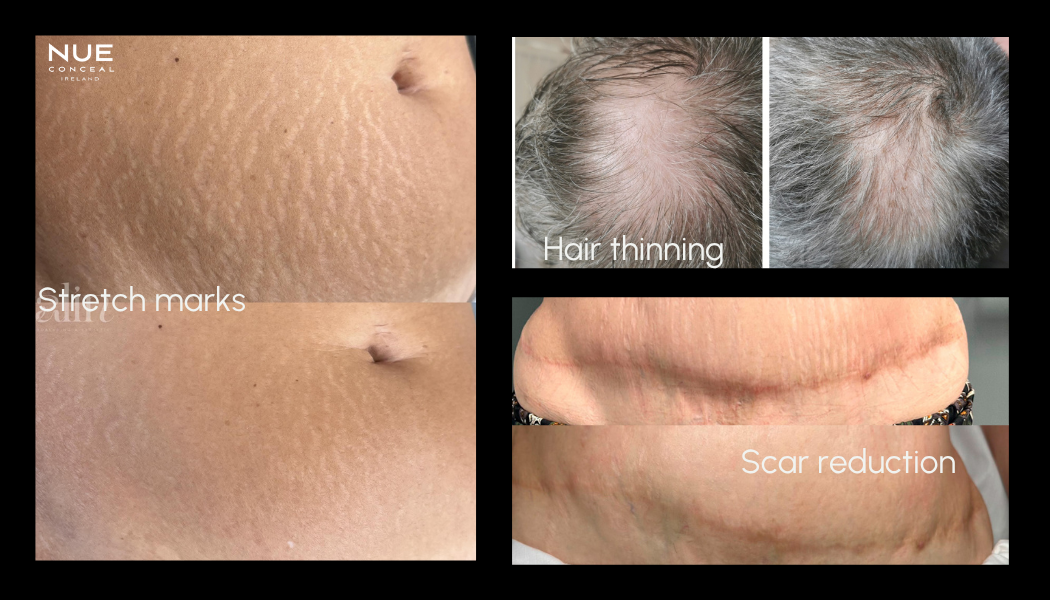 Permanent Makeup